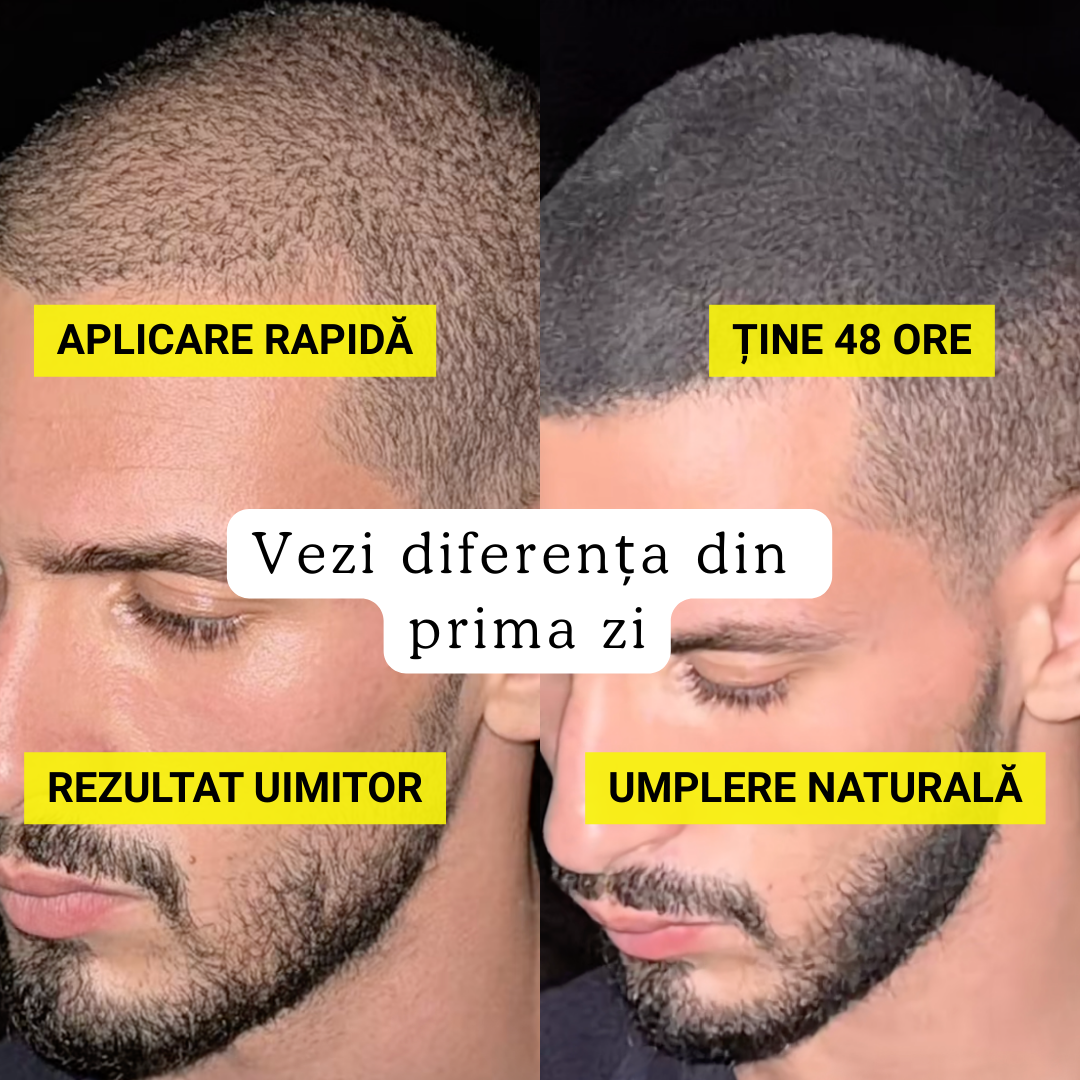 REGENESIS – Păr mai des și natural în câteva secunde